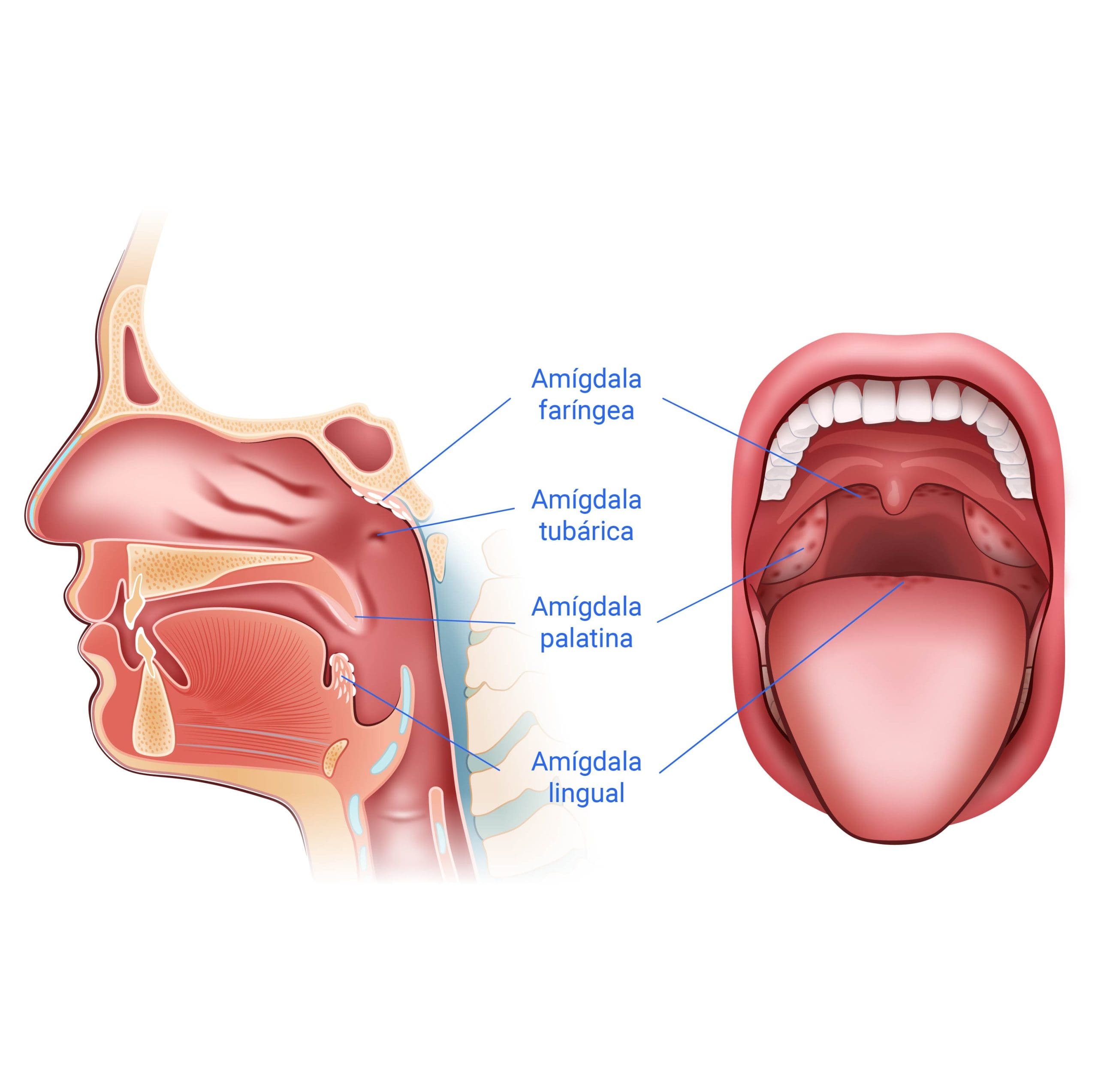 Anatomía de los tonsilolitos