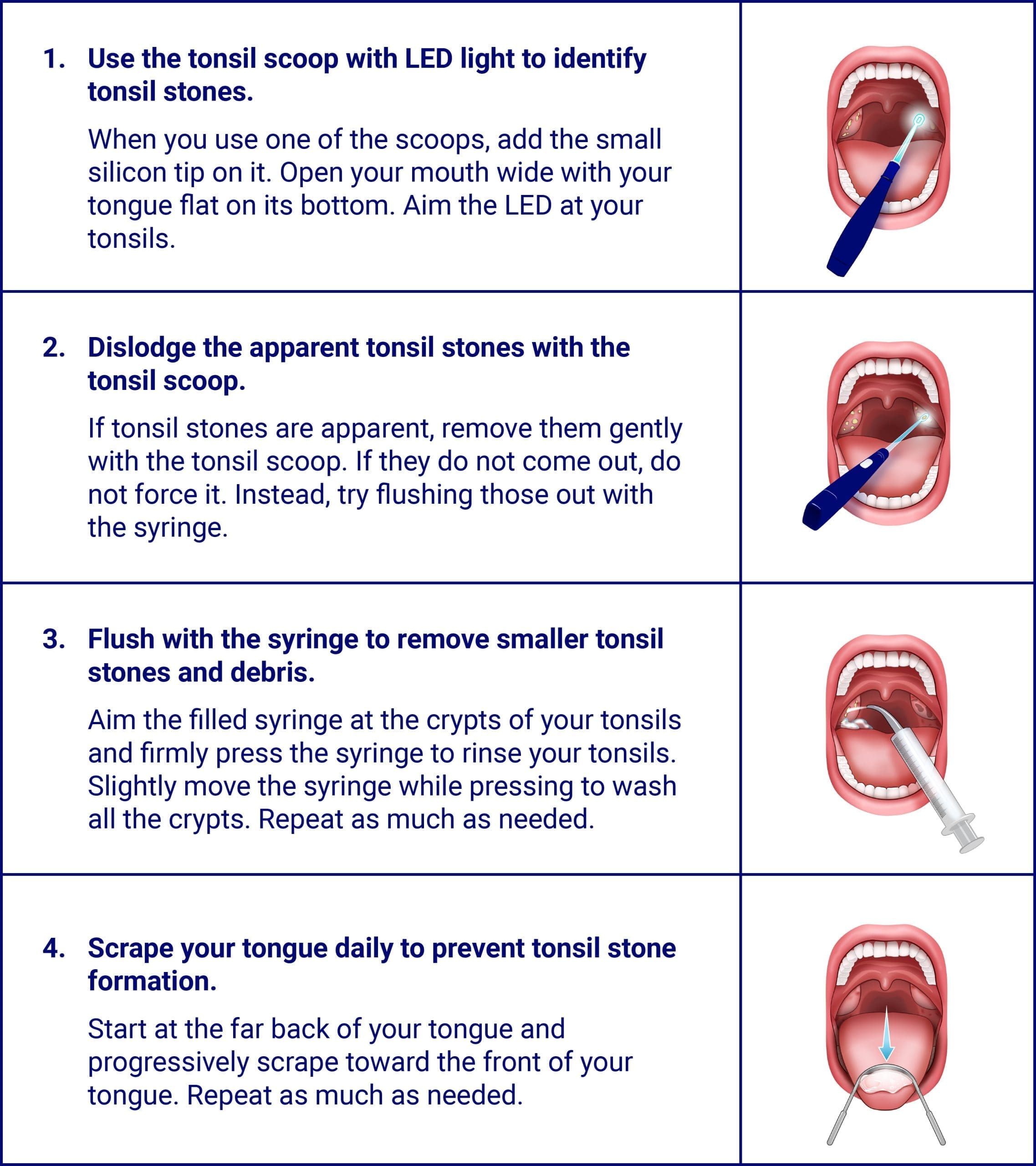 250424~1 step-by-step-guide-how-to-use-oravix-tonsil-stone-removal-kit