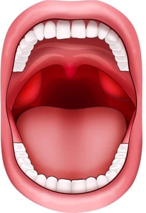 Medical Red Swollen Tonsils