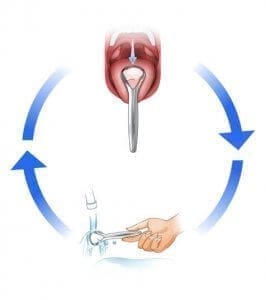 Gratte-langue,grattoir haleine fraîche avec boîte de  rangement,gratte-langue en acier inoxydable arqué,prévenir la mauvaise  haleine