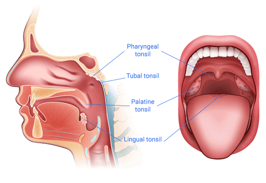 Maux de gorge : faut-il évacuer le caséum dans la gorge ? - AlloDocteurs